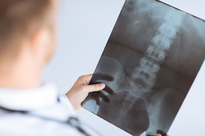 Opțiuni de diagnostic pentru osteochondroza lombară