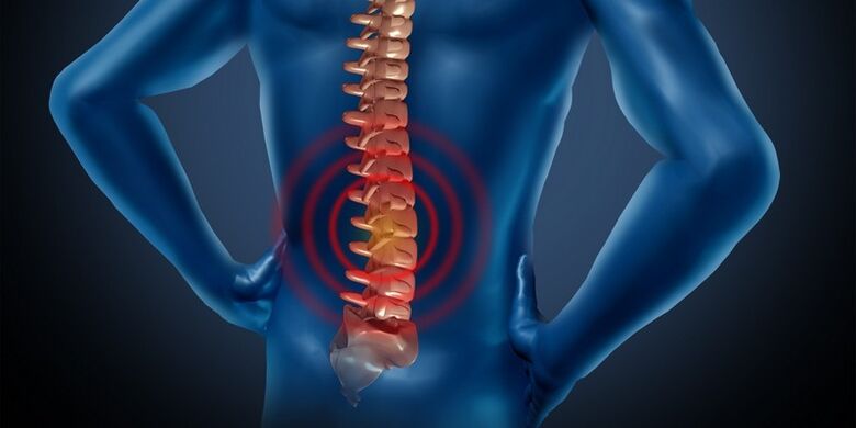 Osteochondroza regiunii lombare